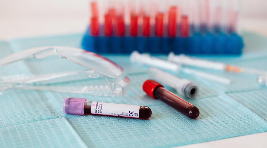 Laboratory glasses and test tubes containing blood